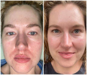 Dark spots image